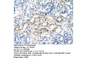 Rabbit Anti-PPP1R8 Antibody  Paraffin Embedded Tissue: Human Kidney Cellular Data: Epithelial cells of renal tubule Antibody Concentration: 4. (PPP1R8 Antikörper  (Middle Region))