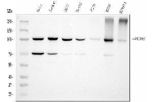 Western blot analysis of MCM6 using anti-MCM6 antibody (ABIN7600038). (MCM6 Antikörper  (AA 14-821))
