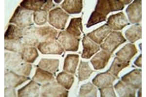 MAP1LC3A immunohistochemistry analysis in formalin fixed and paraffin embedded human skeletal muscle.