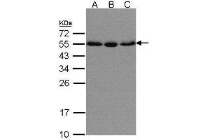 WB Image Sample(30 μg of whole cell lysate) A:HeLa S3, B:Hep G2, C:MOLT4, 10% SDS PAGE antibody diluted at 1:500 (KPNA2 Antikörper  (C-Term))