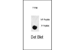 Dot blot analysis of anti-hSD3- Phospho-specific Pab (ABIN389656 and ABIN2850451) on nitrocellulose membrane. (SMAD3 Antikörper  (pSer208))