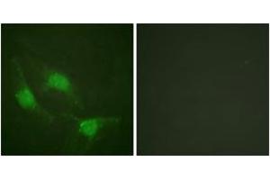 Immunofluorescence analysis of HeLa cells, using p53 (Ab-382) Antibody. (p53 Antikörper  (AA 344-393))