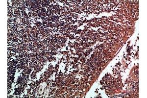 Immunohistochemical analysis of paraffin-embedded human-tonsil, antibody was diluted at 1:200 (Tenascin R Antikörper  (AA 1270-1350))