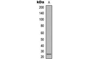 Western blot analysis of LT beta expression in human lymph node (A) whole cell lysates. (LTB Antikörper  (C-Term))