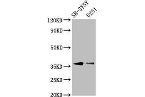 Western Blot Positive WB detected in: SH-SY5Y whole cell lysate, U251 whole cell lysate All lanes: BARHL1 antibody at 3. (BARHL1 Antikörper  (AA 38-176))