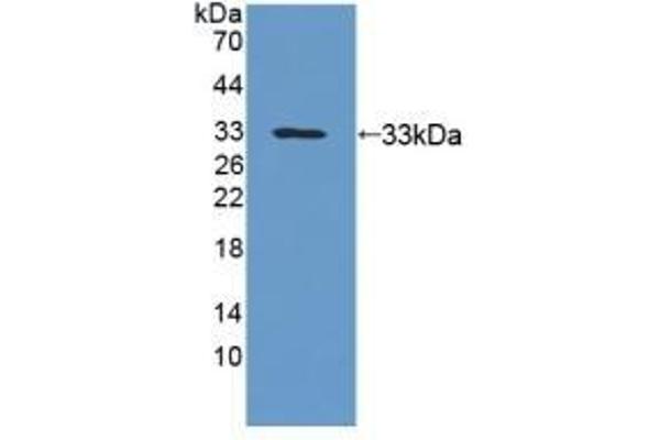 UPB1 Antikörper  (AA 121-384)