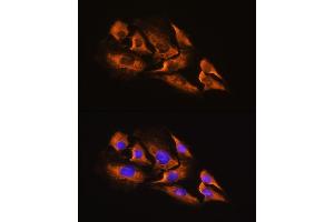 Immunofluorescence analysis of C6 cells using A Rabbit pAb (ABIN3016751, ABIN3016752, ABIN3016753 and ABIN6219833) at dilution of 1:100. (ADRA2A Antikörper  (AA 240-380))