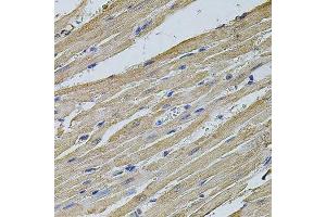 Immunohistochemistry (Paraffin-embedded Sections) (IHC (p)) image for anti-Eukaryotic Translation Initiation Factor 4A2 (EIF4A2) (AA 1-270) antibody (ABIN1679695)