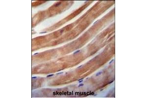 KE antibody (C-term) 0092b immunohistochemistry analysis in formalin fixed and paraffin embedded human skeletal muscle followed by peroxidase conjugation of the secondary antibody and DAB staining. (KEAP1 Antikörper  (C-Term))