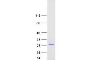 Western Blotting (WB) image for Interferon, alpha 4 (IFNa4) protein (Myc-DYKDDDDK Tag) (ABIN2723319)