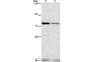 Western blot analysis of HepG2 and hela cell, using NFE2L1 Polyclonal Antibody at dilution of 1:280 (NFE2L1 Antikörper)