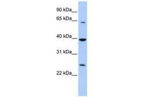 Image no. 1 for anti-Cytosolic Iron-Sulfur Protein Assembly 1 (CIAO1) (AA 144-193) antibody (ABIN6740381) (CIAO1 Antikörper  (AA 144-193))