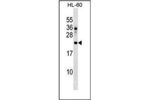 Western blot analysis of DPH4 Antibody  in HL-60 cell line lysates (35ug/lane). (DNAJC24 Antikörper  (Middle Region))