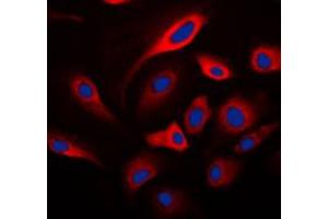 Immunofluorescent analysis of HADH2 staining in SKNSH cells.