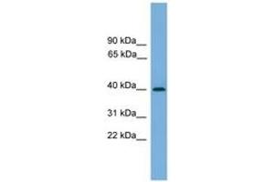Image no. 1 for anti-serpin Peptidase Inhibitor, Clade B (Ovalbumin), Member 8 (SERPINB8) (AA 251-300) antibody (ABIN6745215) (SERPINB8 Antikörper  (AA 251-300))