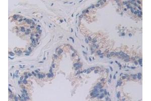 Immunohistochemistry (IHC) image for anti-serine Hydroxymethyltransferase 2 (Mitochondrial) (SHMT2) (AA 30-504) antibody (ABIN7443701)
