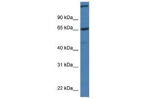 Western Blot showing St6galnac1 antibody used at a concentration of 1.