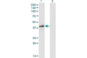 Western Blotting (WB) image for anti-Microtubule-Associated Protein, RP/EB Family, Member 2 (MAPRE2) (AA 1-62) antibody (ABIN564763)