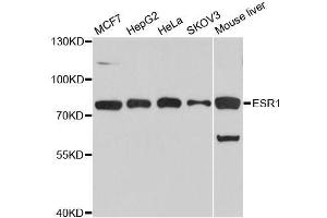 Western blot analysis of extracts of various cell lines, using ESR1 antibody. (Estrogen Receptor alpha Antikörper  (AA 1-190))