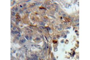 Used in DAB staining on fromalin fixed paraffin-embedded Lung tissue (PKC theta Antikörper  (AA 380-634))