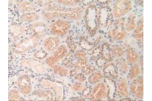 Figure. (PDXK Antikörper  (AA 29-253))