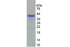 SDS-PAGE analysis of Human Decorin Protein. (Decorin Protein (DCN))