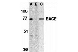 Western Blotting (WB) image for anti-Beta-secretase 1 (BACE1) (C-Term) antibody (ABIN1030276) (BACE1 Antikörper  (C-Term))