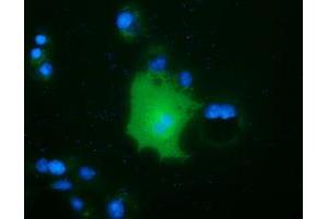 Anti-FAM84B mouse monoclonal antibody (ABIN2453035) immunofluorescent staining of COS7 cells transiently transfected by pCMV6-ENTRY FAM84B (RC207996). (FAM84B Antikörper)