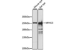 Western blot analysis of extracts of various cell lines, using MYH13 antibody.
