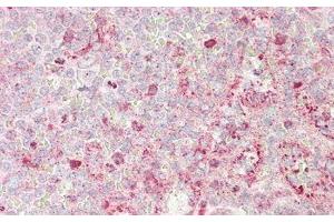 Immunohistochemistry (IHC) image for anti-Superoxide Dismutase 3, Extracellular (SOD3) (AA 19-240) antibody (ABIN7429196)