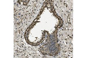 IHC analysis of RPA32/RPA2 using anti-RPA32/RPA2 antibody (ABIN7601380). (RPA2 Antikörper  (AA 34-254))