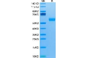 IL5RA Protein (AA 21-335) (His-Avi Tag,Biotin)