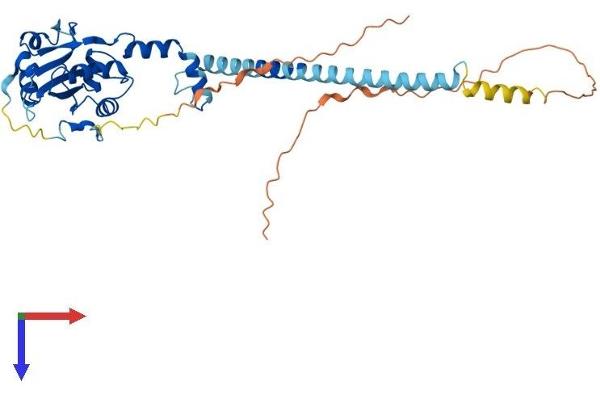 PCYT1B Protein (AA 1-369) (His tag)