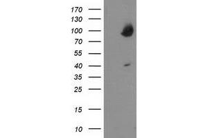 HEK293T cells were transfected with the pCMV6-ENTRY control (Left lane) or pCMV6-ENTRY OSBP (Right lane) cDNA for 48 hrs and lysed. (OSBP Antikörper)