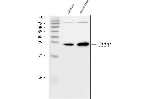Western blot analysis of TPPP using anti-TPPP antibody (ABIN7599102).