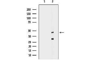 anti-Cyclin-Dependent Kinase 15 (ALS2CR7) (Internal Region) antibody