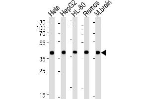 Western Blotting (WB) image for anti-Glutamic-Oxaloacetic Transaminase 2, Mitochondrial (Aspartate Aminotransferase 2) (GOT2) (AA 33-61), (N-Term) antibody (ABIN652917)