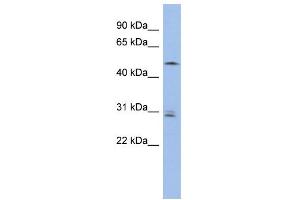 WB Suggested Anti-SMAP1 Antibody Titration: 0. (SMAP1 Antikörper  (Middle Region))