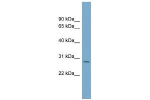 C1ORF96 antibody used at 1 ug/ml to detect target protein. (CCSAP Antikörper  (N-Term))