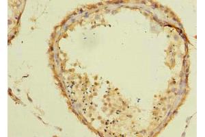 Immunohistochemistry of paraffin-embedded human testis tissue using ABIN7171826 at dilution of 1:100 (Twisted Gastrulation BMP Signaling Modulator 1a (TWSG1A) (AA 1-200) Antikörper)