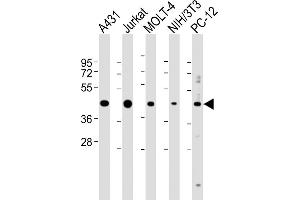 Western Blotting (WB) image for anti-Argininosuccinate Synthase 1 (ASS1) (AA 192-221) antibody (ABIN390810)