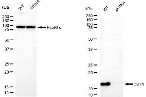 Western blotting analysis using DSTN antibody (ABIN7798320).