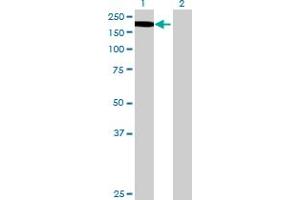 Lane 1: MAP3K5 transfected lysate ( 151. (MAP3K5 293T Cell Transient Overexpression Lysate(Denatured))