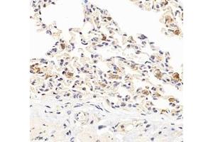 Immunohistochemistry of paraffin embedded rat lung using HSP70B (ABIN7074173) at dilution of 1: 1000 (400x lens) (HSPA6 Antikörper)