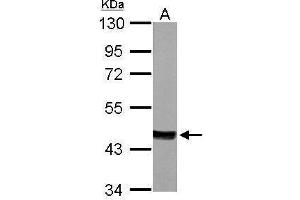 Western Blotting (WB) image for anti-Mevalonate (Diphospho) Decarboxylase (MVD) (Center) antibody (ABIN2856802)