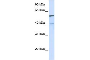 WB Suggested Anti-UGT1A6 Antibody Titration:  0.
