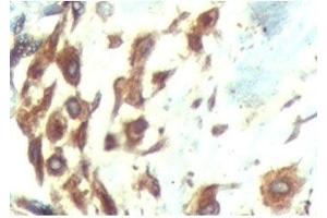 IHC testing of FFPE human breast tissue with ATF6 antibody at 5ug/ml. (ATF6 Antikörper  (N-Term))