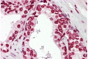 Anti-MKX antibody IHC staining of human prostate. (MKX Antikörper  (AA 191-240))