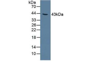 Detection of AGXT in Rat Liver Tissue using Polyclonal Antibody to Alanine Glyoxylate Aminotransferase (AGXT) (AGXT Antikörper  (AA 182-371))