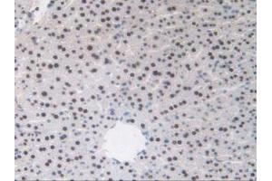 IHC-P analysis of Mouse Liver Tissue, with DAB staining. (TALDO1 Antikörper  (AA 35-285))